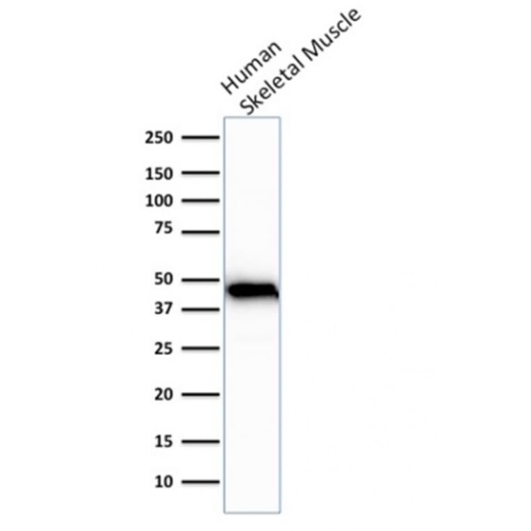 Western Blot - Anti-Muscle Actin Antibody [rMSA/953] (A277943) - Antibodies.com