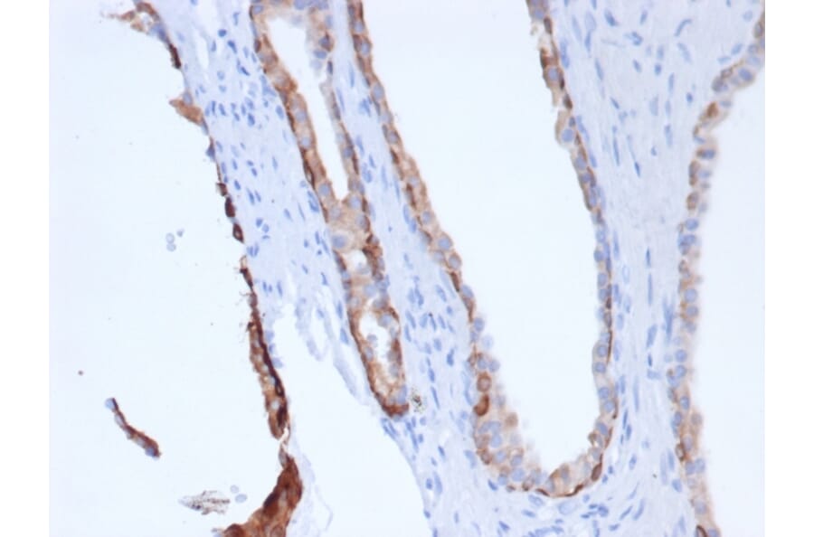 Immunohistochemistry - Anti-pan Cytokeratin Antibody [Cocktail rPCK/6750] (A277944) - Antibodies.com