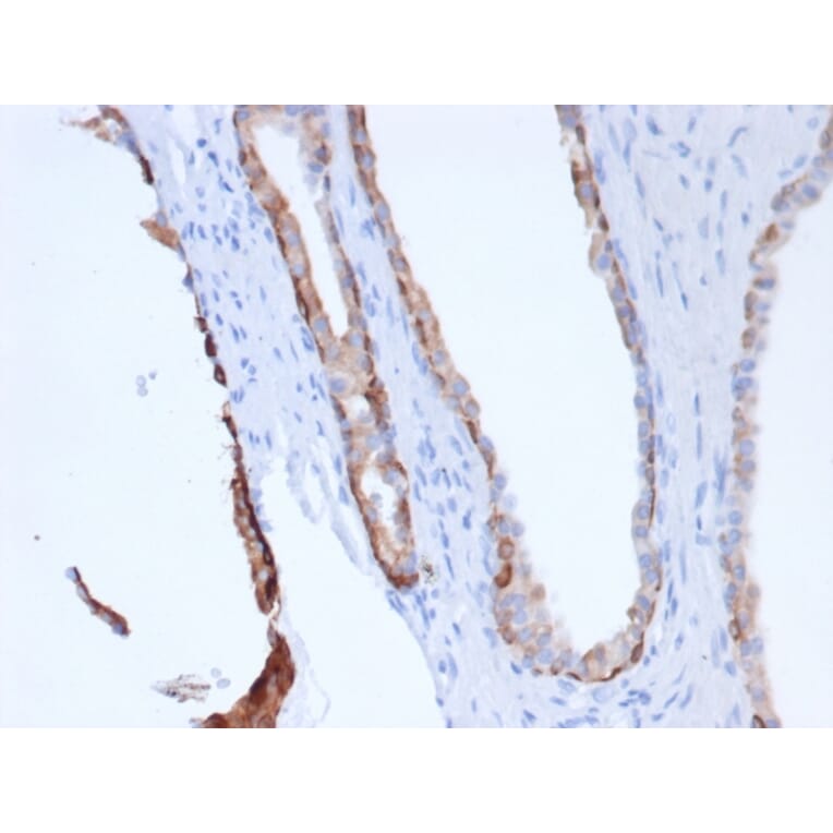 Immunohistochemistry - Anti-pan Cytokeratin Antibody [Cocktail rPCK/6750] (A277944) - Antibodies.com