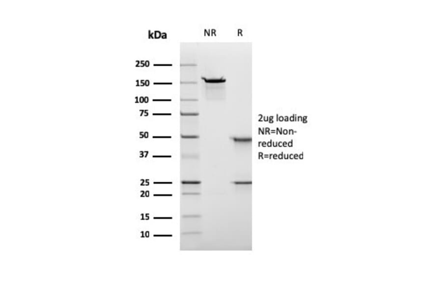 SDS-PAGE - Anti-Nuclear Antigen Antibody [rNM106] (A277945) - Antibodies.com