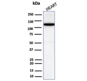 Western Blot - Anti-N Cadherin Antibody [CDH2/6857R] (A277946) - Antibodies.com