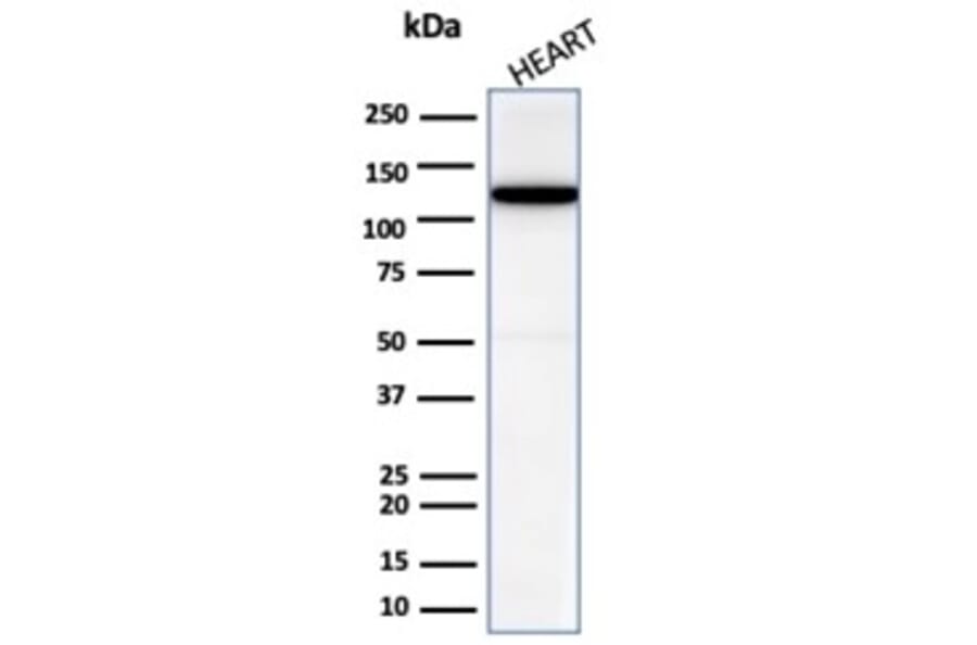 Western Blot - Anti-N Cadherin Antibody [CDH2/6857R] (A277946) - Antibodies.com