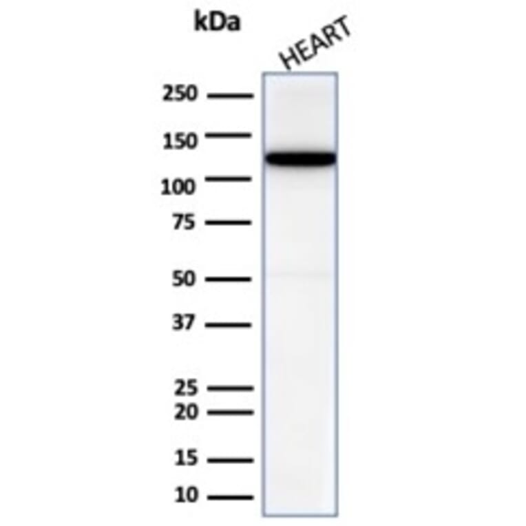 Western Blot - Anti-N Cadherin Antibody [CDH2/6857R] (A277946) - Antibodies.com