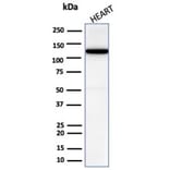 Western Blot - Anti-N Cadherin Antibody [CDH2/6857R] (A277946) - Antibodies.com