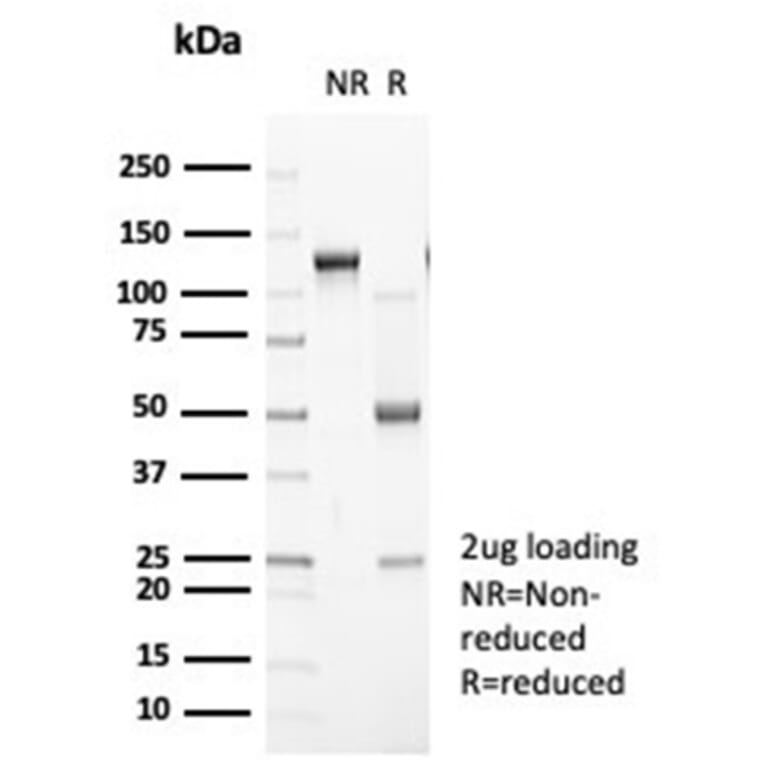 SDS-PAGE - Anti-N Cadherin Antibody [CDH2/7070R] (A277947) - Antibodies.com