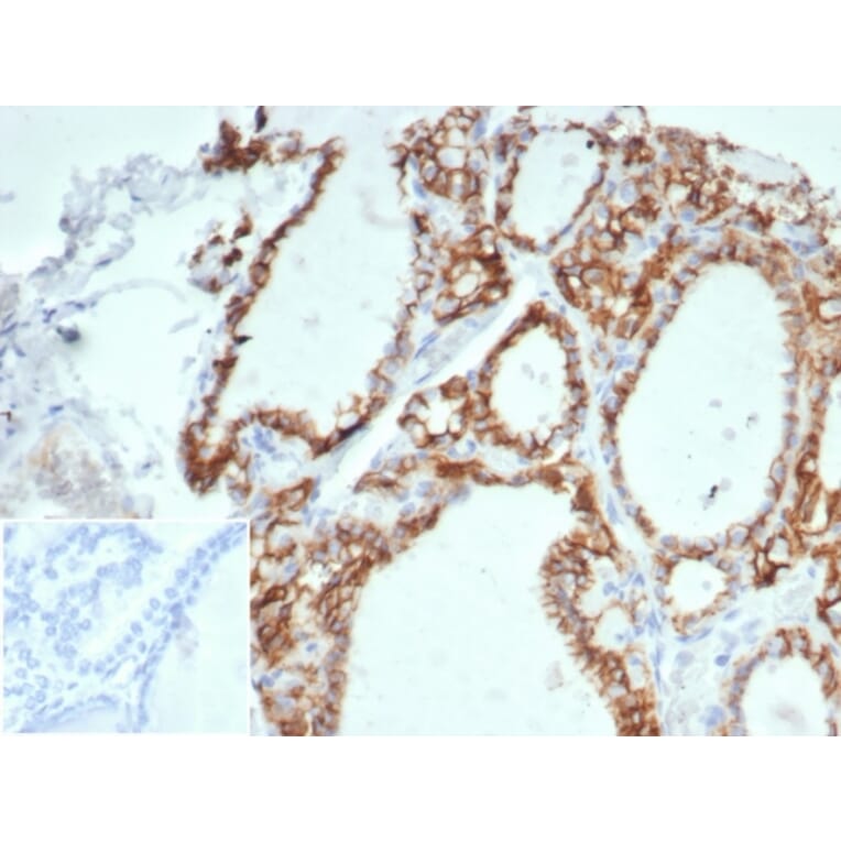 Immunohistochemistry - Anti-Cadherin 16 Antibody [CDH16/7027R] (A277948) - Antibodies.com