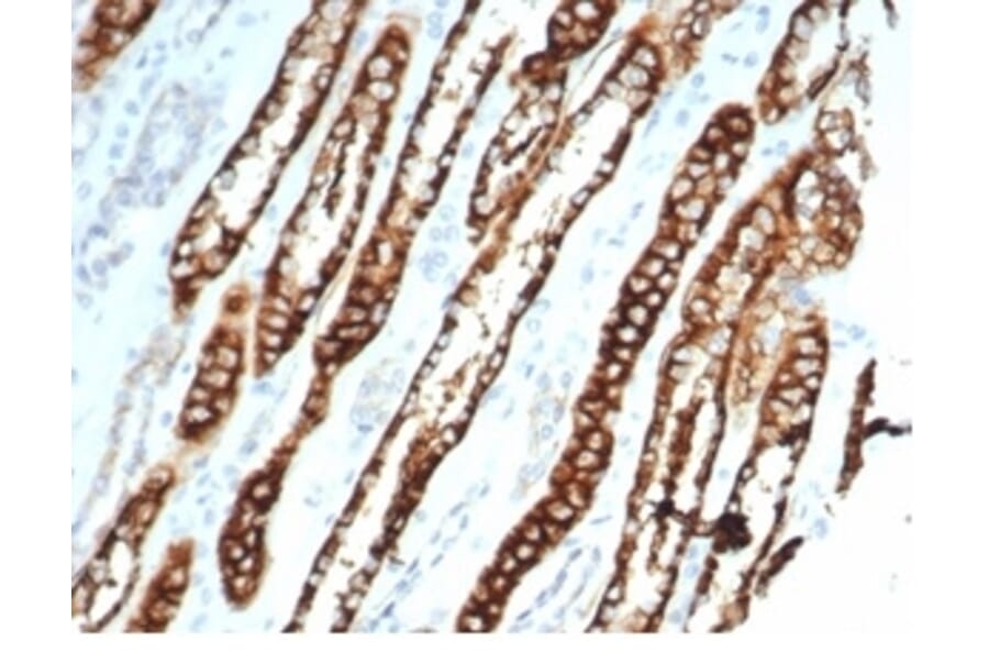 Immunohistochemistry - Anti-Cadherin 16 Antibody [CDH16/7027R] (A277948) - Antibodies.com