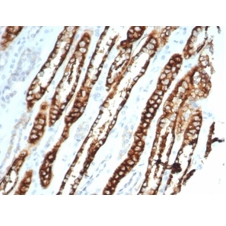 Immunohistochemistry - Anti-Cadherin 16 Antibody [CDH16/7027R] (A277948) - Antibodies.com