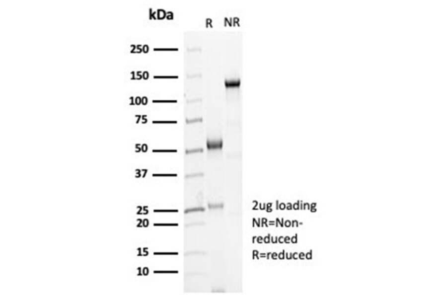 SDS-PAGE - Anti-Cadherin 16 Antibody [CDH16/7028R] (A277949) - Antibodies.com