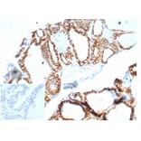 Immunohistochemistry - Anti-Cadherin 16 Antibody [CDH16/7028R] (A277949) - Antibodies.com