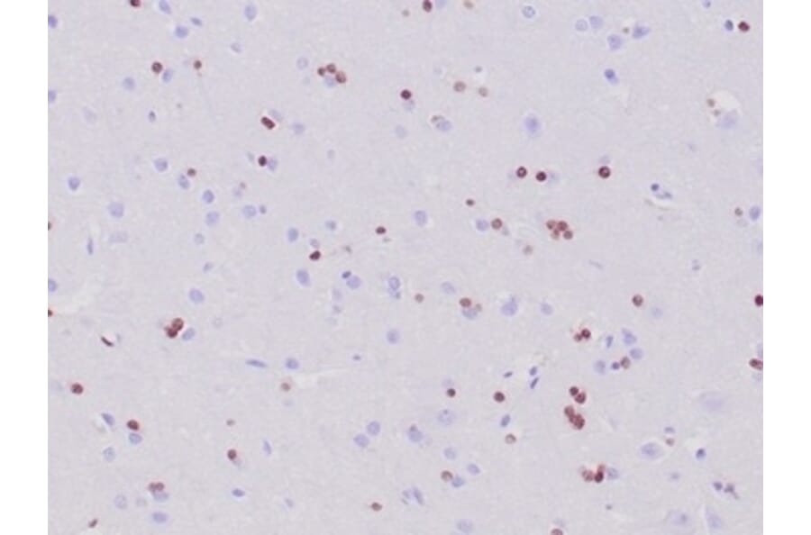 Immunohistochemistry - Anti-OLIG2 Antibody [OLIG2/6695R] (A277950) - Antibodies.com