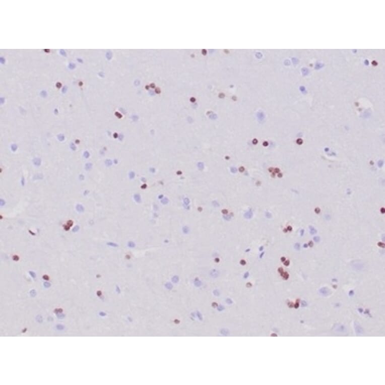 Immunohistochemistry - Anti-OLIG2 Antibody [OLIG2/6695R] (A277950) - Antibodies.com