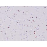 Immunohistochemistry - Anti-OLIG2 Antibody [OLIG2/6695R] (A277950) - Antibodies.com