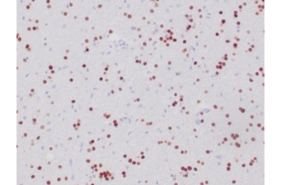 Immunohistochemistry - Anti-OLIG2 Antibody [OLIG2/6695R] (A277950) - Antibodies.com
