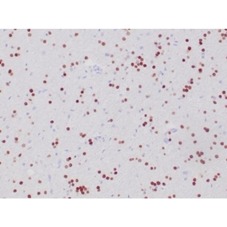 Immunohistochemistry - Anti-OLIG2 Antibody [OLIG2/6695R] (A277950) - Antibodies.com