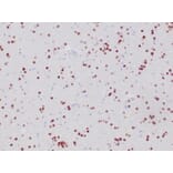 Immunohistochemistry - Anti-OLIG2 Antibody [OLIG2/6695R] (A277950) - Antibodies.com