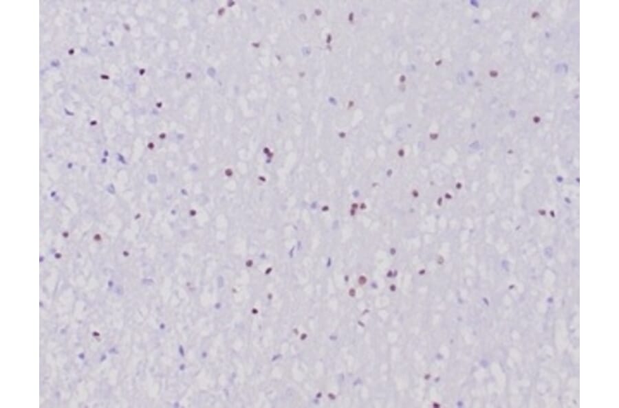 Immunohistochemistry - Anti-OLIG2 Antibody [OLIG2/6695R] (A277950) - Antibodies.com
