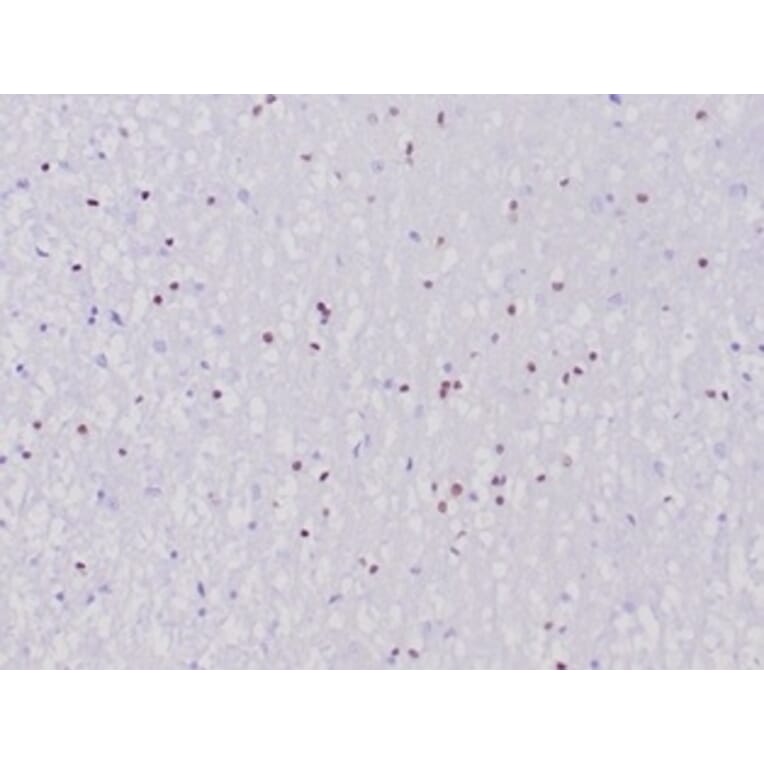 Immunohistochemistry - Anti-OLIG2 Antibody [OLIG2/6695R] (A277950) - Antibodies.com