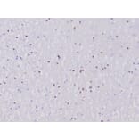 Immunohistochemistry - Anti-OLIG2 Antibody [OLIG2/6695R] (A277950) - Antibodies.com