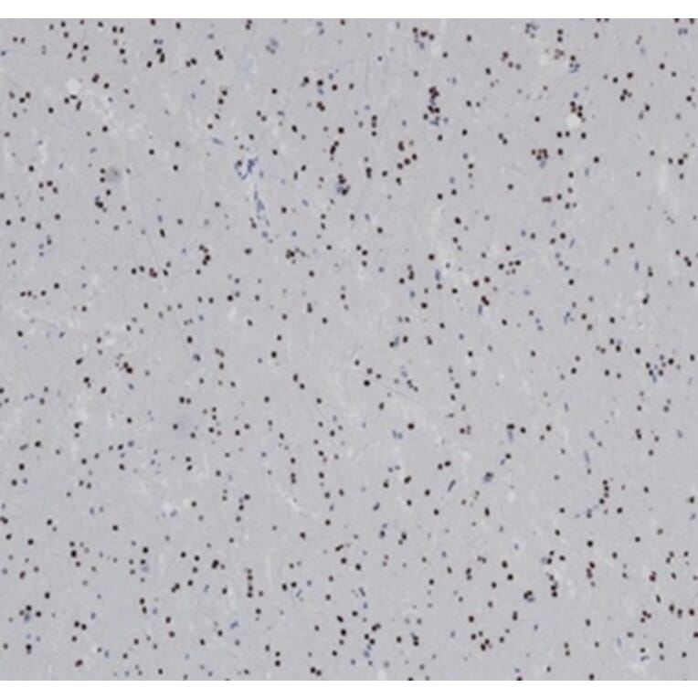 Immunohistochemistry - Anti-OLIG2 Antibody [OLIG2/6695R] (A277950) - Antibodies.com