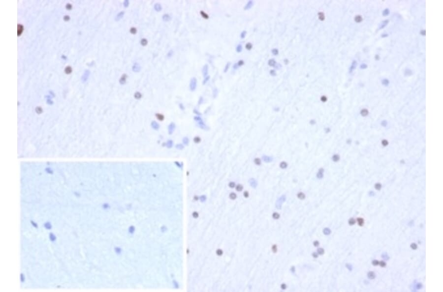 Immunohistochemistry - Anti-OLIG2 Antibody [OLIG2/6695R] (A277950) - Antibodies.com