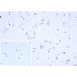 Immunohistochemistry - Anti-OLIG2 Antibody [OLIG2/6695R] (A277950) - Antibodies.com