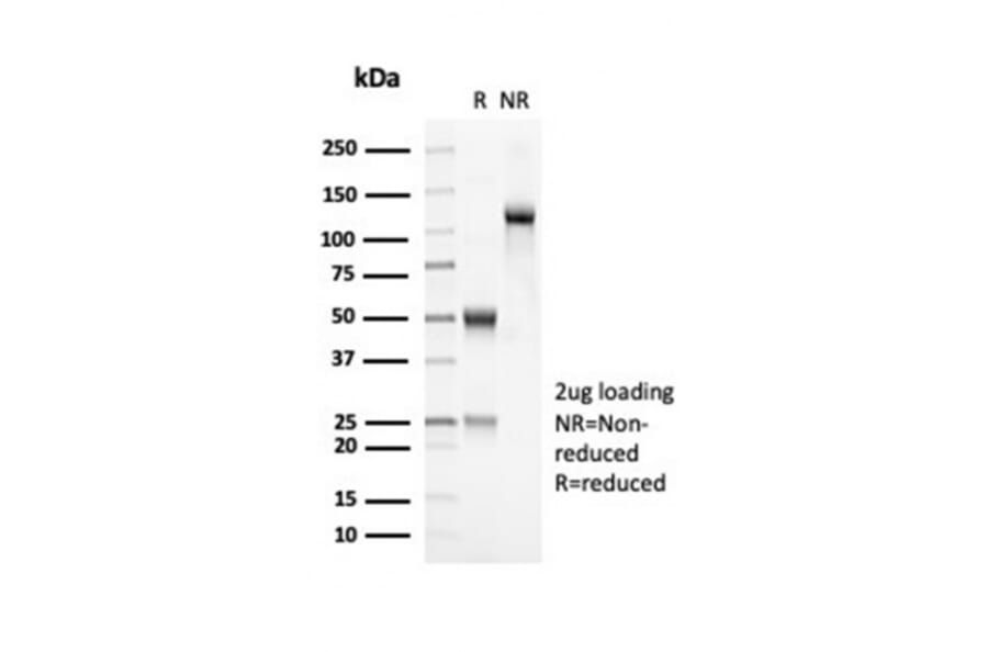 SDS-PAGE - Anti-OLIG2 Antibody [OLIG2/7074R] (A277951) - Antibodies.com