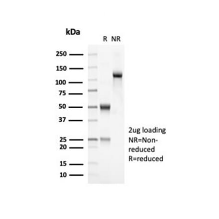 SDS-PAGE - Anti-OLIG2 Antibody [OLIG2/7074R] (A277951) - Antibodies.com