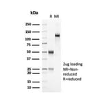 SDS-PAGE - Anti-OLIG2 Antibody [OLIG2/7074R] (A277951) - Antibodies.com