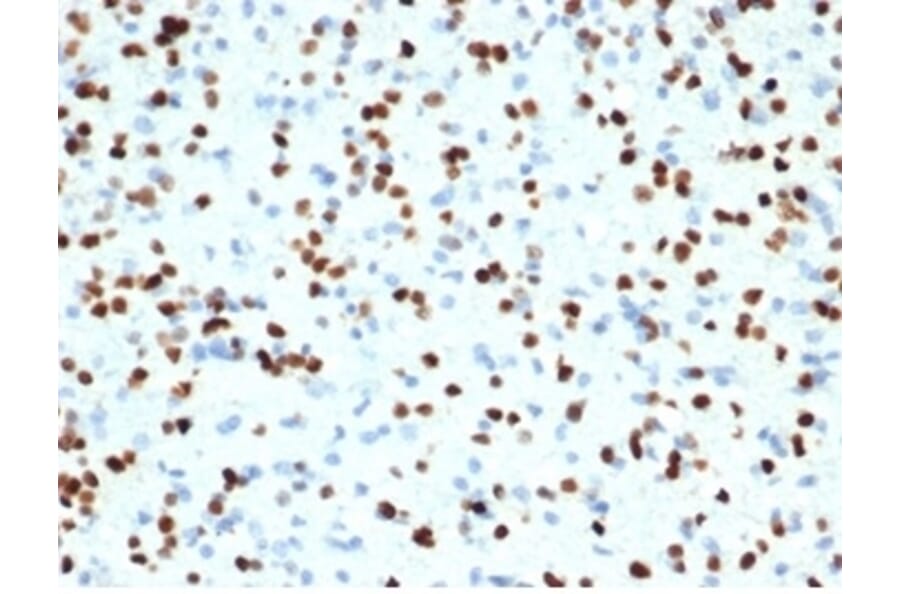 Immunohistochemistry - Anti-OLIG2 Antibody [OLIG2/7074R] (A277951) - Antibodies.com