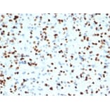 Immunohistochemistry - Anti-OLIG2 Antibody [OLIG2/7074R] (A277951) - Antibodies.com
