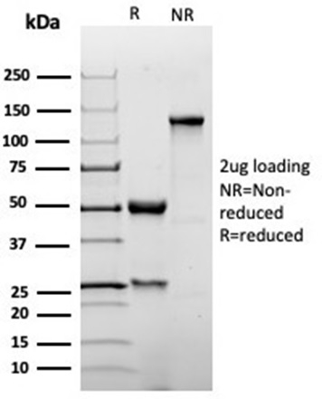 SDS-PAGE - Anti-p27 Kip1 Antibody [KIP1/1355R] (A277952) - Antibodies.com