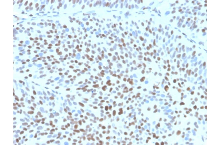 Immunohistochemistry - Anti-p27 Kip1 Antibody [KIP1/1355R] (A277952) - Antibodies.com