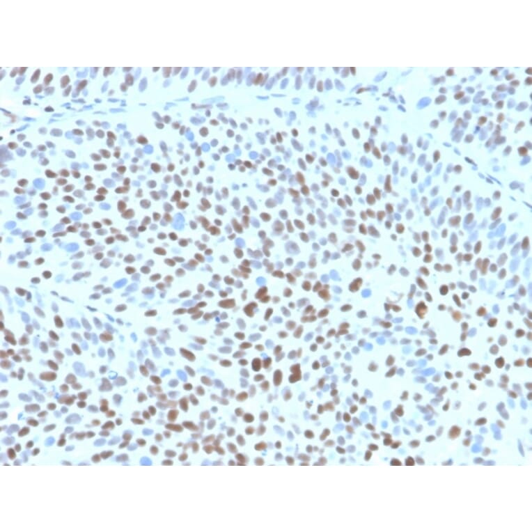 Immunohistochemistry - Anti-p27 Kip1 Antibody [KIP1/1355R] (A277952) - Antibodies.com