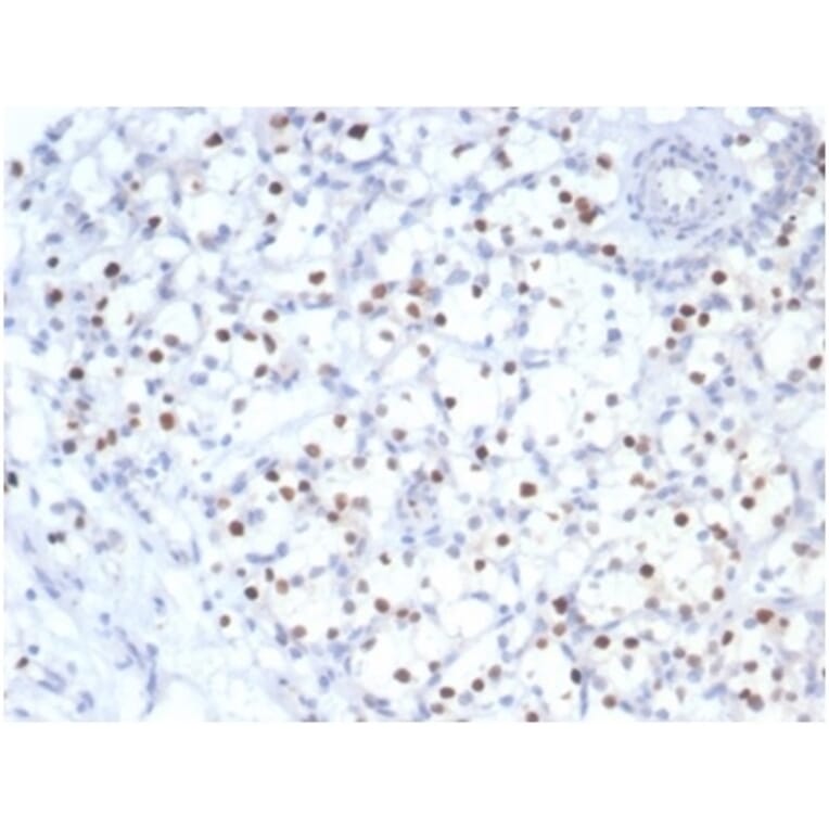 Immunohistochemistry - Anti-p57 Kip2 Antibody [KIP2/7083R] (A277953) - Antibodies.com