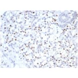 Immunohistochemistry - Anti-p57 Kip2 Antibody [KIP2/7083R] (A277953) - Antibodies.com