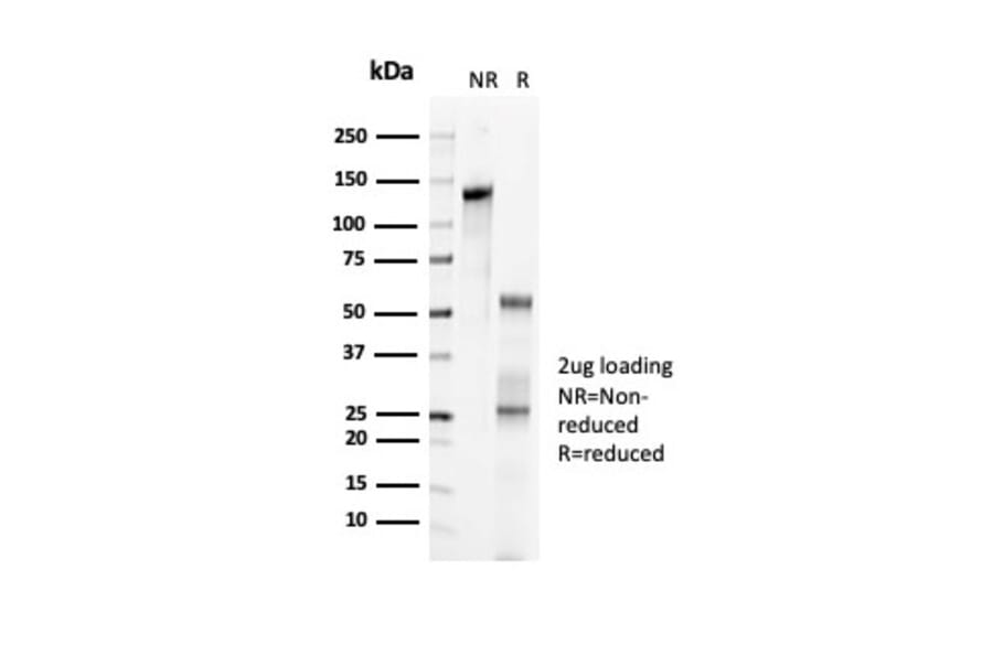 SDS-PAGE - Anti-p57 Kip2 Antibody [KIP2/7083R] (A277953) - Antibodies.com