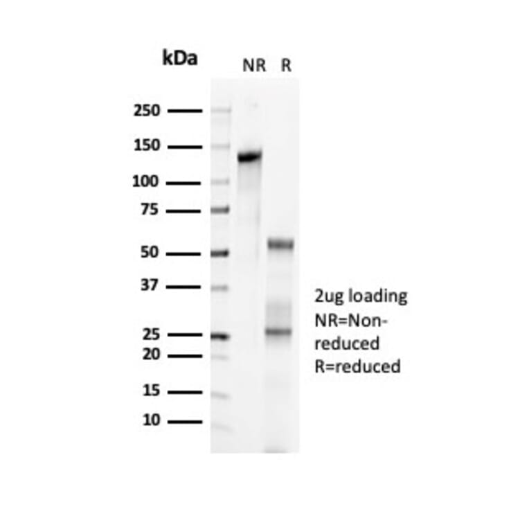 SDS-PAGE - Anti-p57 Kip2 Antibody [KIP2/7083R] (A277953) - Antibodies.com