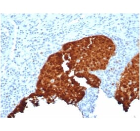 Immunohistochemistry - Anti-p16INK4a Antibody [CDKN2A/4844R] (A277954) - Antibodies.com