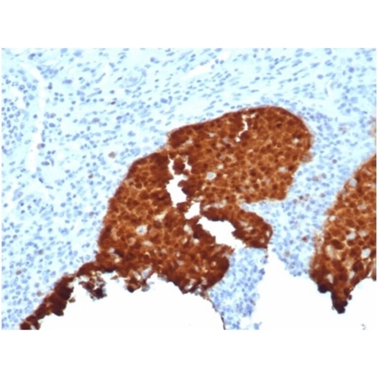 Immunohistochemistry - Anti-p16INK4a Antibody [CDKN2A/4844R] (A277954) - Antibodies.com