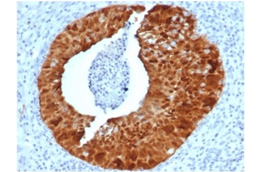 Immunohistochemistry - Anti-p16INK4a Antibody [CDKN2A/4844R] (A277954) - Antibodies.com