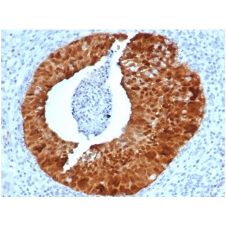 Immunohistochemistry - Anti-p16INK4a Antibody [CDKN2A/4844R] (A277954) - Antibodies.com