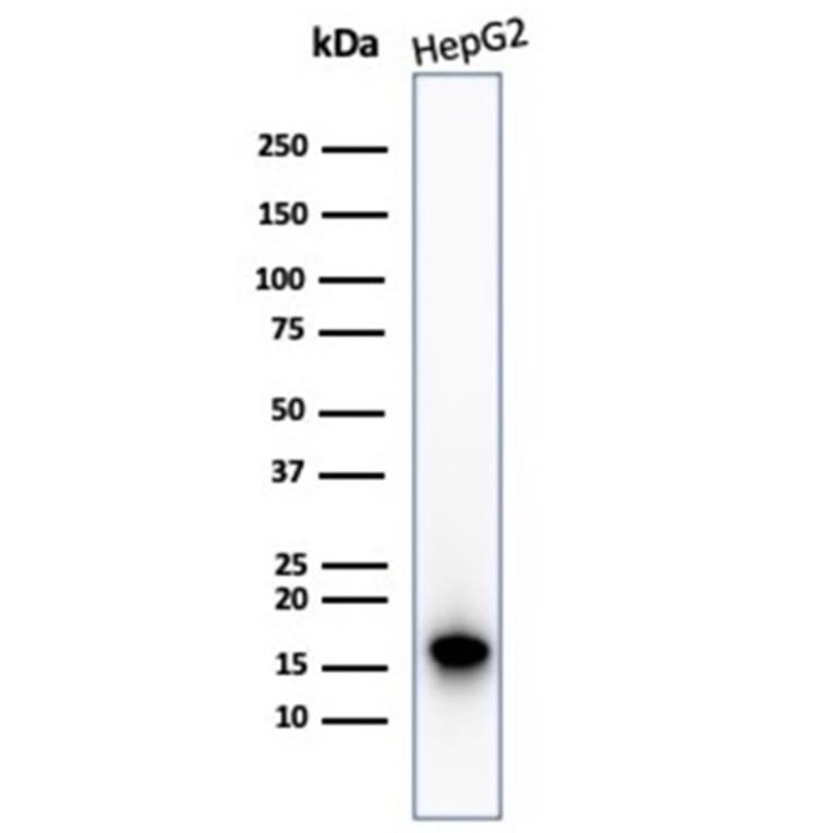 Western Blot - Anti-p16INK4a Antibody [CDKN2A/4844R] (A277954) - Antibodies.com