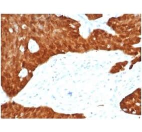 Immunohistochemistry - Anti-p16INK4a Antibody [CDKN2A/7081R] (A277955) - Antibodies.com