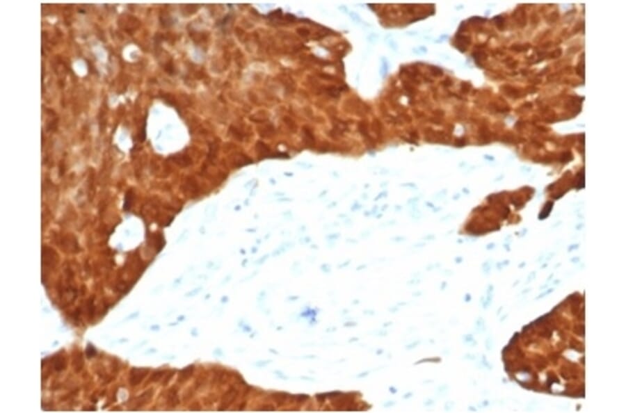 Immunohistochemistry - Anti-p16INK4a Antibody [CDKN2A/7081R] (A277955) - Antibodies.com