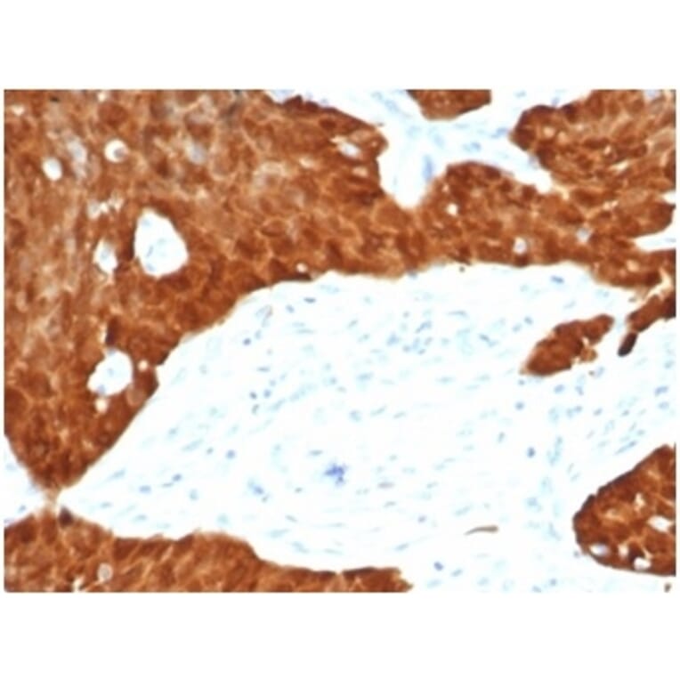 Immunohistochemistry - Anti-p16INK4a Antibody [CDKN2A/7081R] (A277955) - Antibodies.com