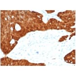 Immunohistochemistry - Anti-p16INK4a Antibody [CDKN2A/7081R] (A277955) - Antibodies.com