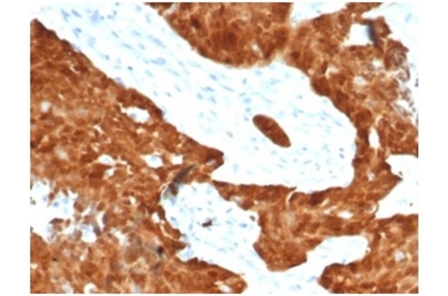 Immunohistochemistry - Anti-p16INK4a Antibody [CDKN2A/7081R] (A277955) - Antibodies.com