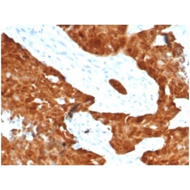 Immunohistochemistry - Anti-p16INK4a Antibody [CDKN2A/7081R] (A277955) - Antibodies.com