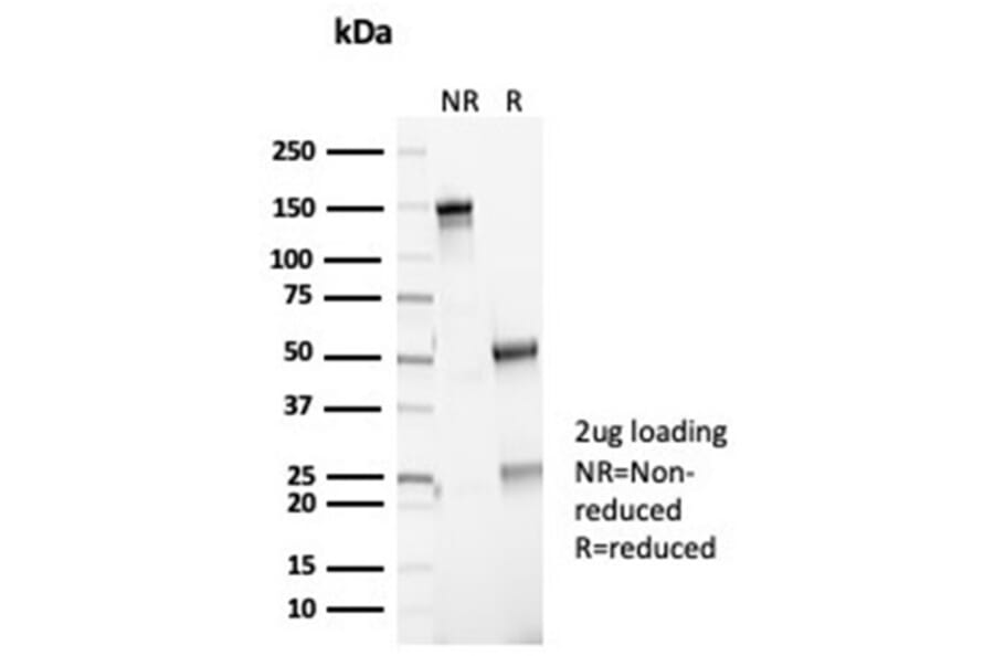 SDS-PAGE - Anti-p16INK4a Antibody [CDKN2A/7081R] (A277955) - Antibodies.com